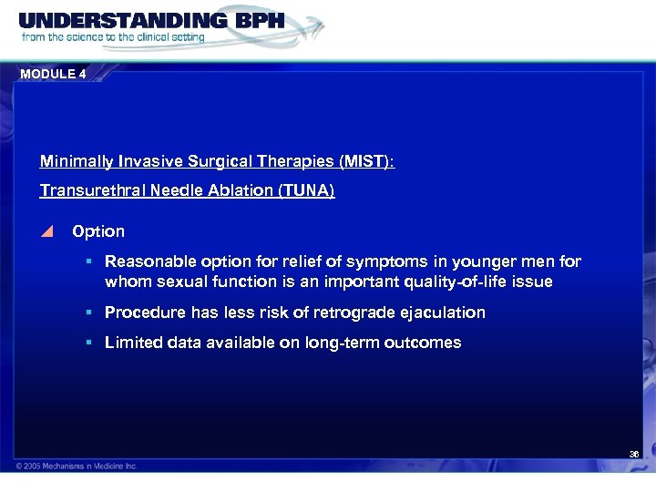 MODULE 4 Minimally Invasive Surgical Therapies (MIST): Transurethral Needle Ablation (TUNA) y Option §