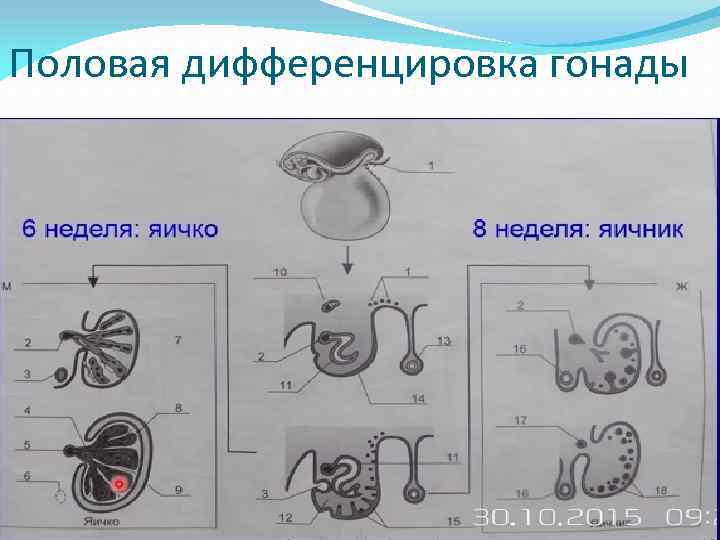 Половая дифференцировка гонады 