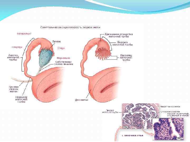 Маточные трубы 