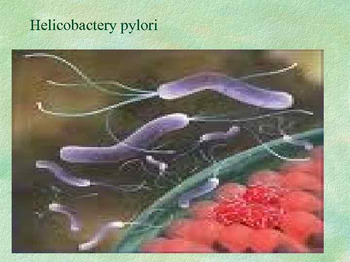 Helicobactery pylori 