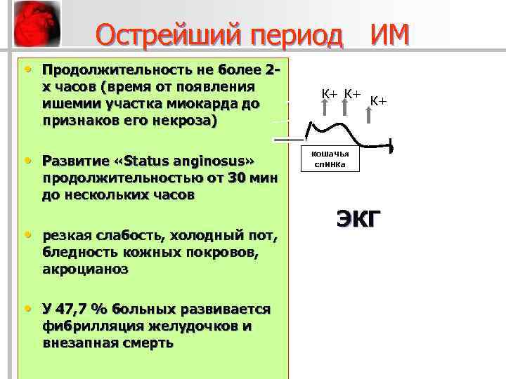 Острейший период ИМ • Продолжительность не более 2 х часов (время от появления ишемии