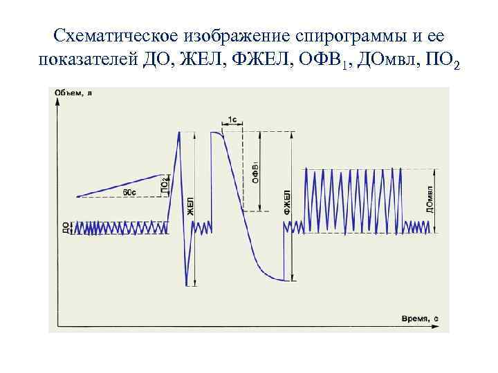 Схематическое изображение спирограммы и ее показателей ДО, ЖЕЛ, ФЖЕЛ, ОФВ 1, ДОмвл, ПО 2