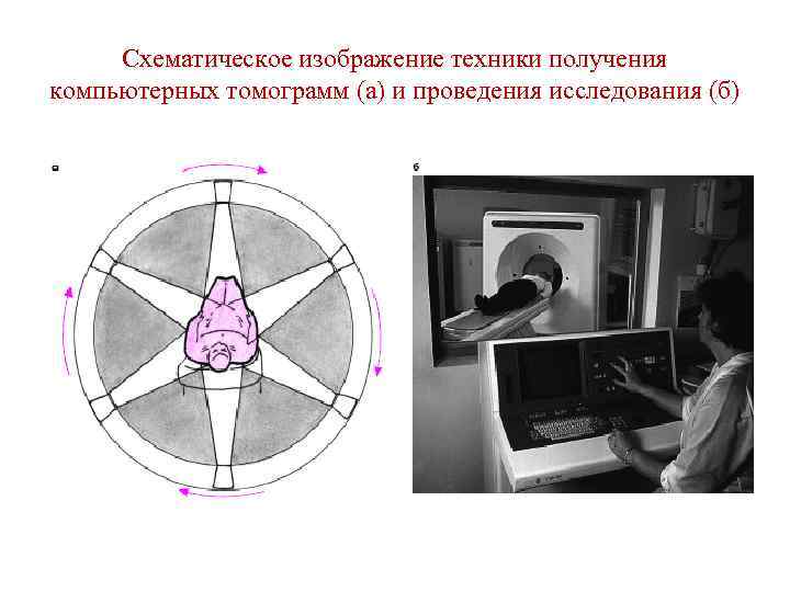 Схематическое изображение техники получения компьютерных томограмм (а) и проведения исследования (б) 