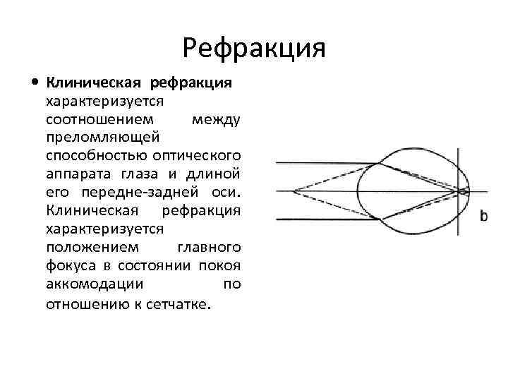 Рефракция Клиническая рефракция характеризуется соотношением между преломляющей способностью оптического аппарата глаза и длиной его