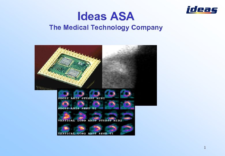 Ideas ASA The Medical Technology Company 1 