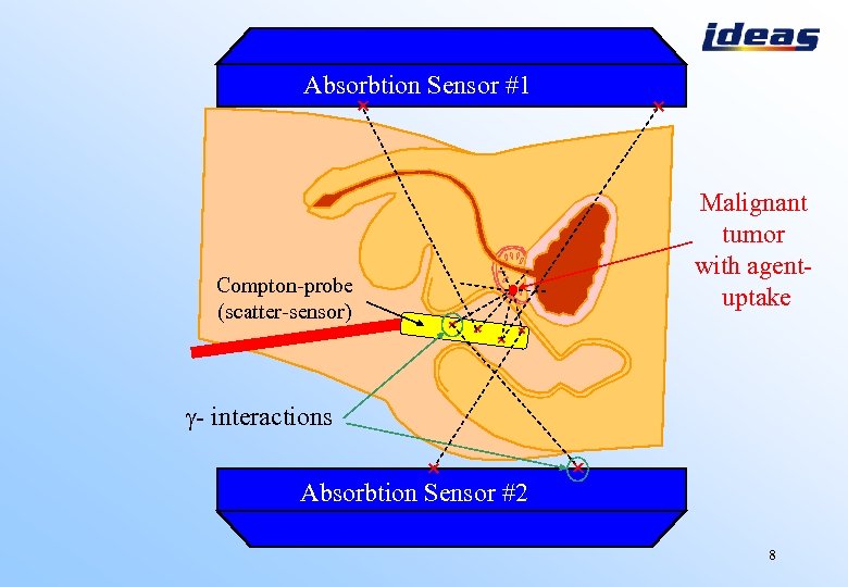 Absorbtion Sensor #1 How it works Compton-probe (scatter-sensor) Malignant tumor with agentuptake - interactions