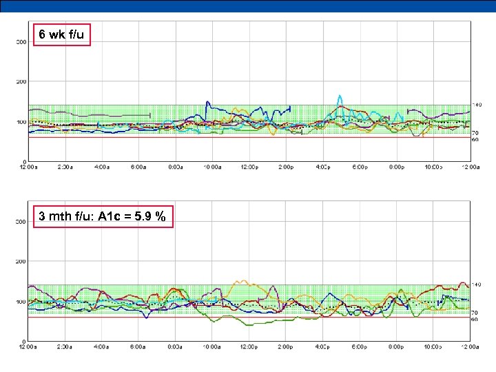 6 wk f/u 3 mth f/u: A 1 c = 5. 9 % 