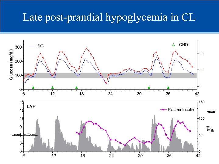 Late post-prandial hypoglycemia in CL 