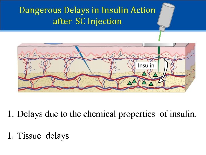 Dangerous Delays in Insulin Action after SC Injection 1. Delays due to the chemical