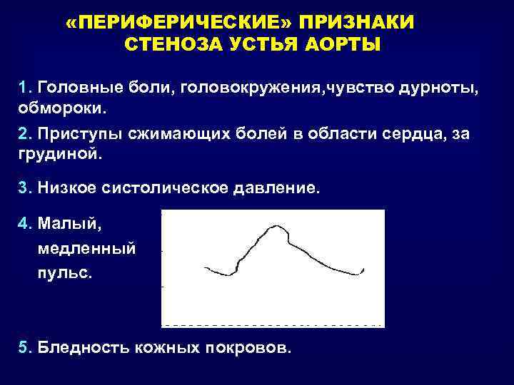  «ПЕРИФЕРИЧЕСКИЕ» ПРИЗНАКИ СТЕНОЗА УСТЬЯ АОРТЫ 1. Головные боли, головокружения, чувство дурноты, обмороки. 2.