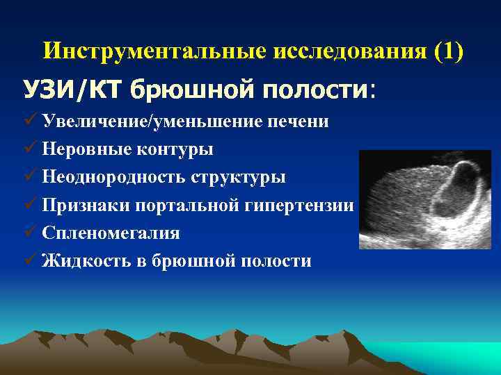 Инструментальные исследования (1) УЗИ/КТ брюшной полости: ü Увеличение/уменьшение печени ü Неровные контуры ü Неоднородность