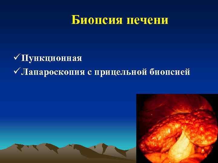 Биопсия печени ü Пункционная ü Лапароскопия с прицельной биопсией 