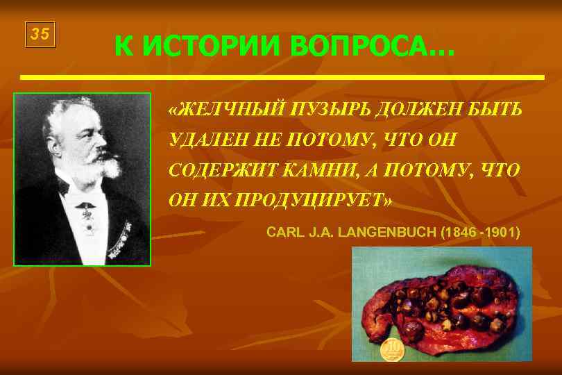 35 К ИСТОРИИ ВОПРОСА… «ЖЕЛЧНЫЙ ПУЗЫРЬ ДОЛЖЕН БЫТЬ УДАЛЕН НЕ ПОТОМУ, ЧТО ОН СОДЕРЖИТ