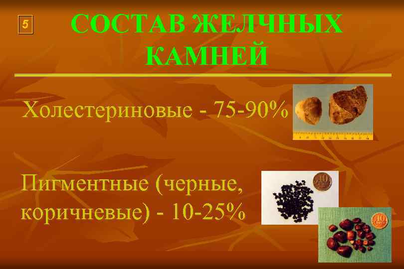5 СОСТАВ ЖЕЛЧНЫХ КАМНЕЙ Холестериновые - 75 -90% Пигментные (черные, коричневые) - 10 -25%