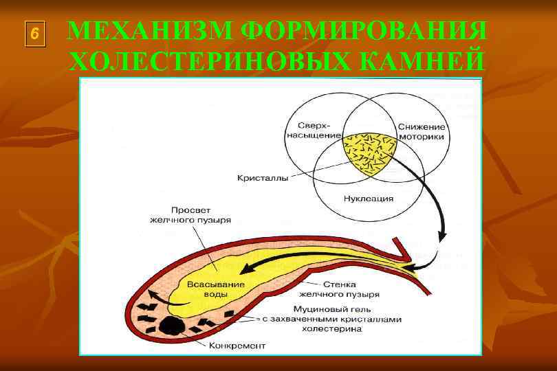 6 МЕХАНИЗМ ФОРМИРОВАНИЯ ХОЛЕСТЕРИНОВЫХ КАМНЕЙ 