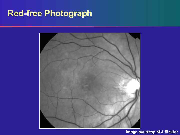 Red-free Photograph Image courtesy of J Slakter 