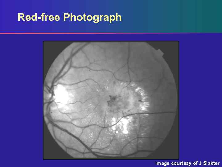 Red-free Photograph Image courtesy of J Slakter 