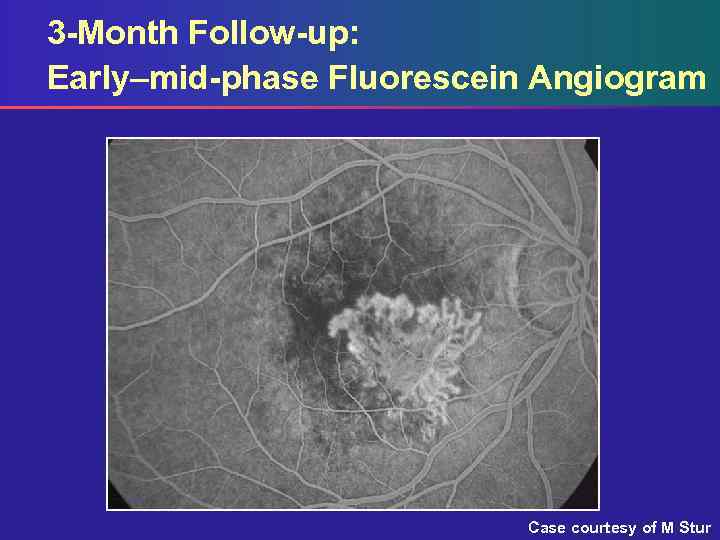 3 -Month Follow-up: Early–mid-phase Fluorescein Angiogram Case courtesy of M Stur 
