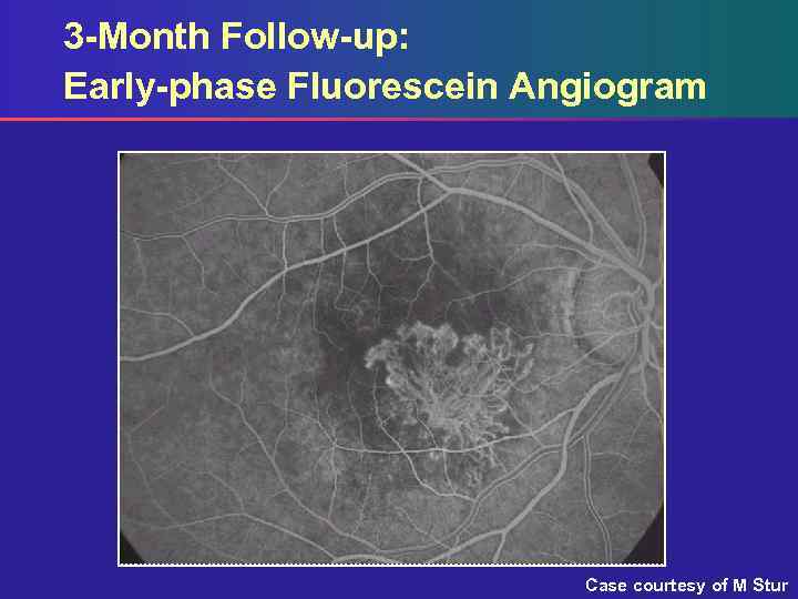 3 -Month Follow-up: Early-phase Fluorescein Angiogram Case courtesy of M Stur 