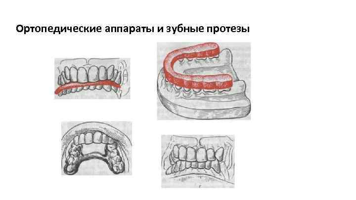 Ортопедические аппараты и зубные протезы 