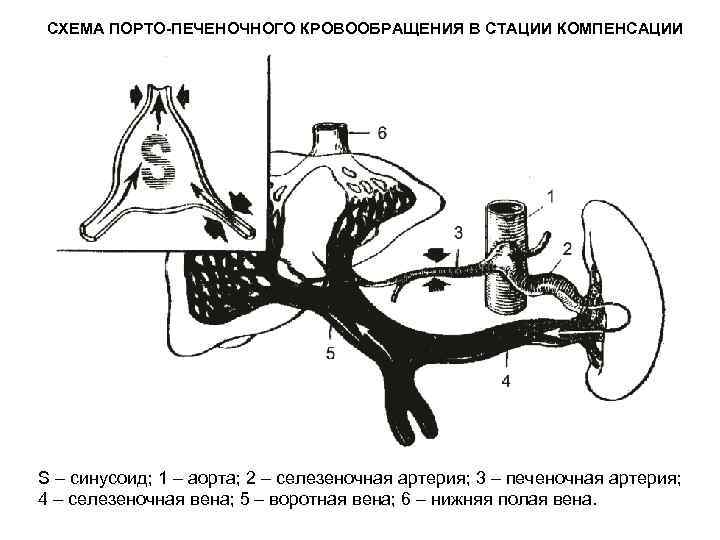 СХЕМА ПОРТО-ПЕЧЕНОЧНОГО КРОВООБРАЩЕНИЯ В СТАЦИИ КОМПЕНСАЦИИ S – синусоид; 1 – аорта; 2 –