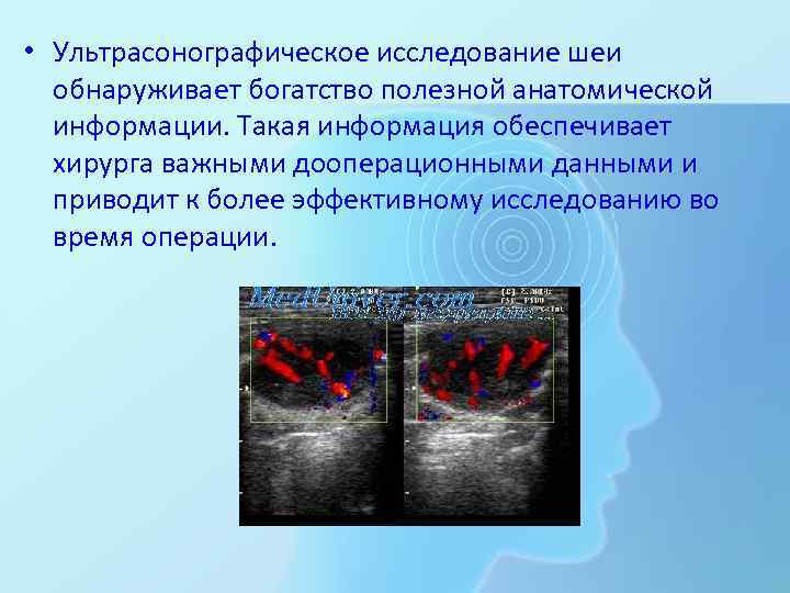  • Ультрасонографическое исследование шеи обнаруживает богатство полезной анатомической информации. Такая информация обеспечивает хирурга