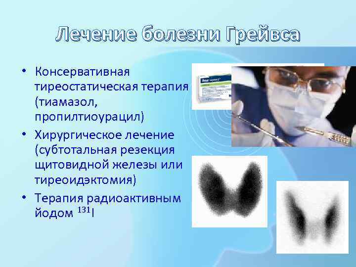Лечение болезни Грейвса • Консервативная тиреостатическая терапия (тиамазол, пропилтиоурацил) • Хирургическое лечение (субтотальная резекция