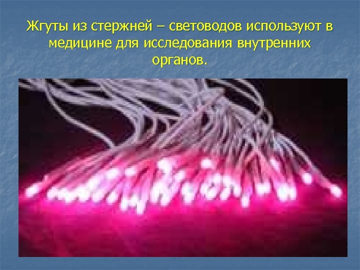 Жгуты из стержней – световодов используют в медицине для исследования внутренних органов. 