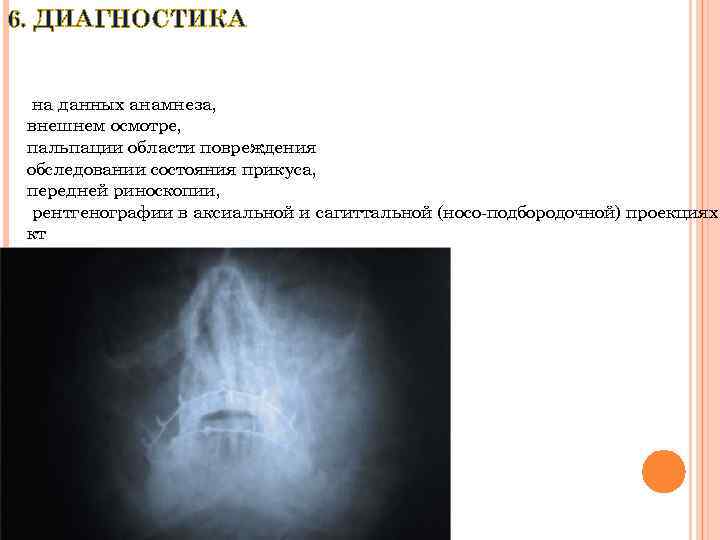 6. ДИАГНОСТИКА на данных анамнеза, внешнем осмотре, пальпации области повреждения обследовании состояния прикуса, передней