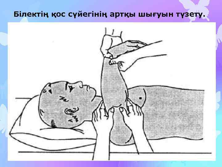 Білектің қос сүйегінің артқы шығуын түзету. 