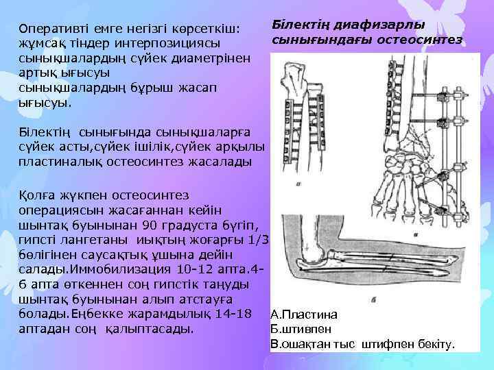 Оперативті емге негізгі көрсеткіш: жұмсақ тіндер интерпозициясы сынықшалардың сүйек диаметрінен артық ығысуы сынықшалардың бұрыш