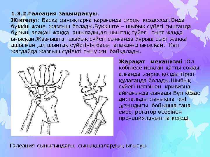 1. 3. 2. Галеация зақымдануы. Жіктелуі: Басқа сынықтарға қарағанда сирек кездеседі. Онда бүккіш және