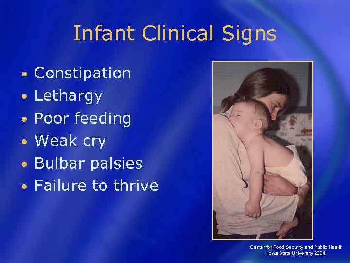 Infant Clinical Signs • • • Constipation Lethargy Poor feeding Weak cry Bulbar palsies