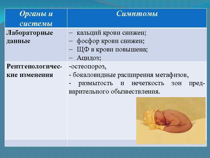 Презентация на тему профилактика рахита у детей