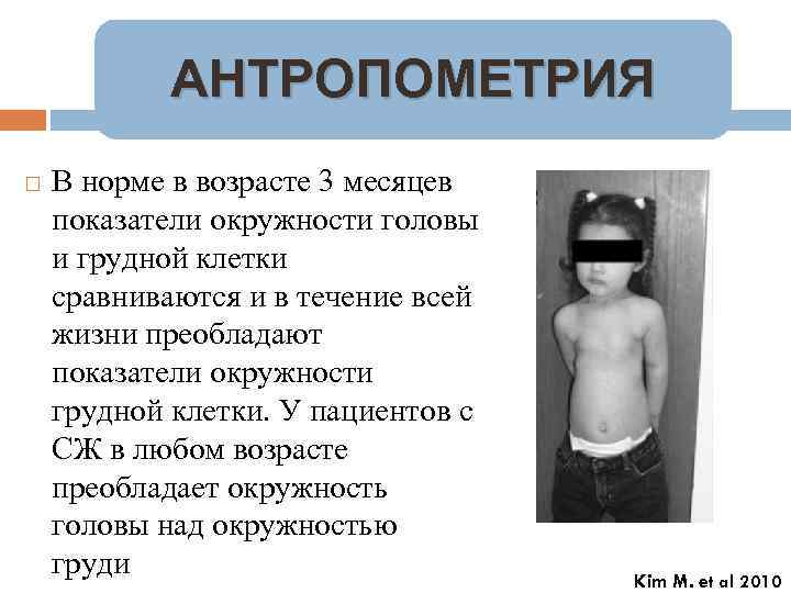 АНТРОПОМЕТРИЯ В норме в возрасте 3 месяцев показатели окружности головы и грудной клетки сравниваются