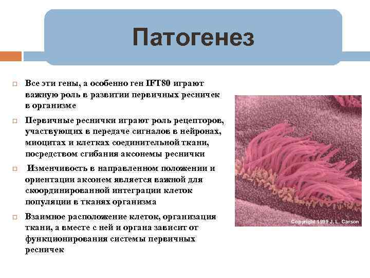 Патогенез Все эти гены, а особенно ген IFT 80 играют важную роль в развитии