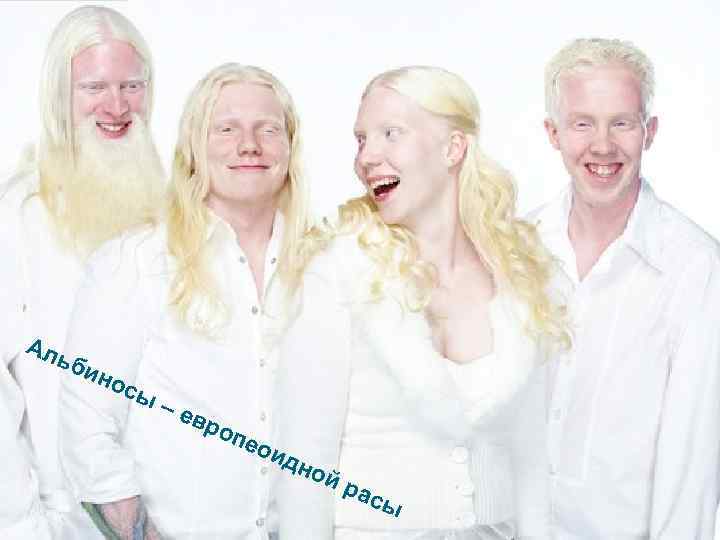 Ал ьб ино сы –е вро пео ид ной рас ы 