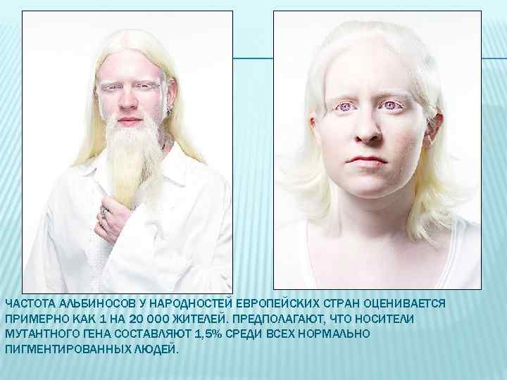 ЧАСТОТА АЛЬБИНОСОВ У НАРОДНОСТЕЙ ЕВРОПЕЙСКИХ СТРАН ОЦЕНИВАЕТСЯ ПРИМЕРНО КАК 1 НА 20 000 ЖИТЕЛЕЙ.