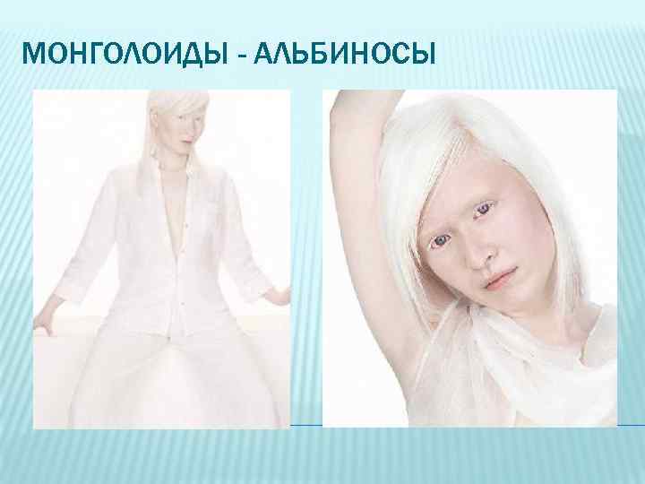 МОНГОЛОИДЫ - АЛЬБИНОСЫ 