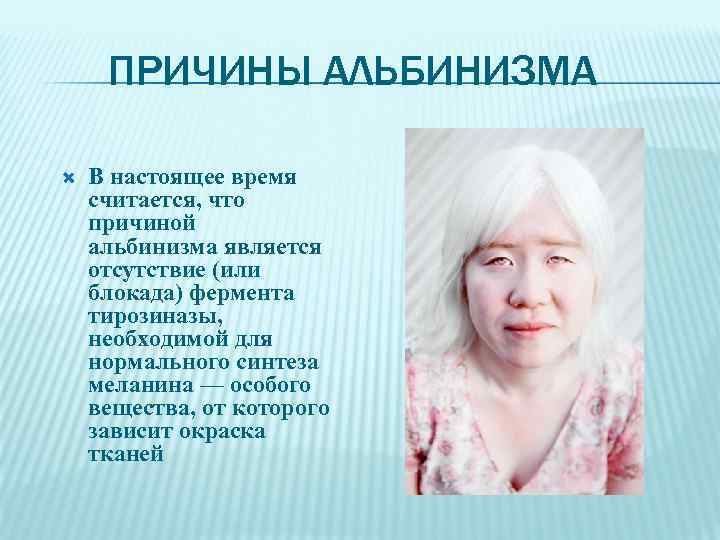 ПРИЧИНЫ АЛЬБИНИЗМА В настоящее время считается, что причиной альбинизма является отсутствие (или блокада) фермента