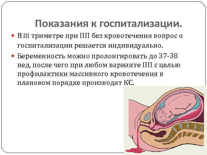 Показания к госпитализации. В III триметре при ПП без кровотечения вопрос о госпитализации решается