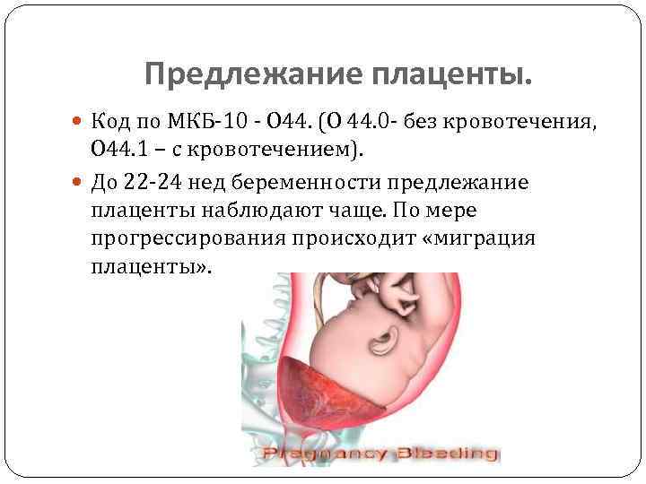 Предлежание плаценты. Код по МКБ-10 - О 44. (О 44. 0 - без кровотечения,