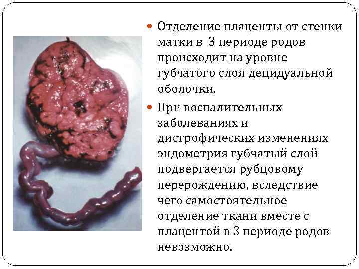  Отделение плаценты от стенки матки в 3 периоде родов происходит на уровне губчатого