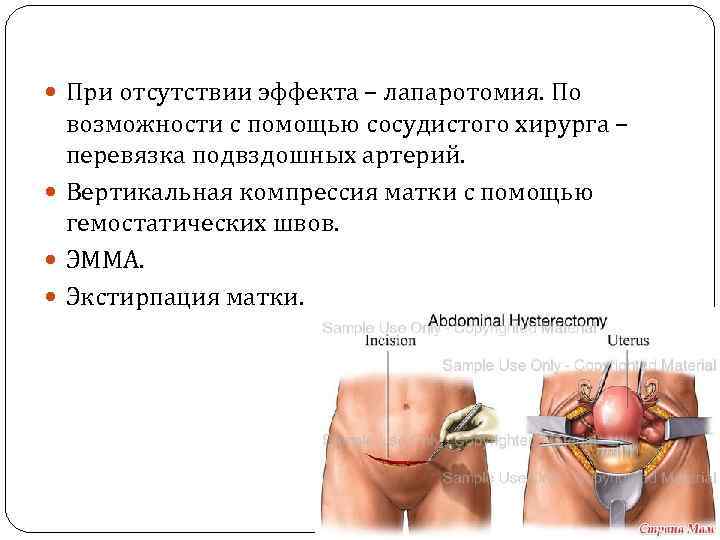  При отсутствии эффекта – лапаротомия. По возможности с помощью сосудистого хирурга – перевязка