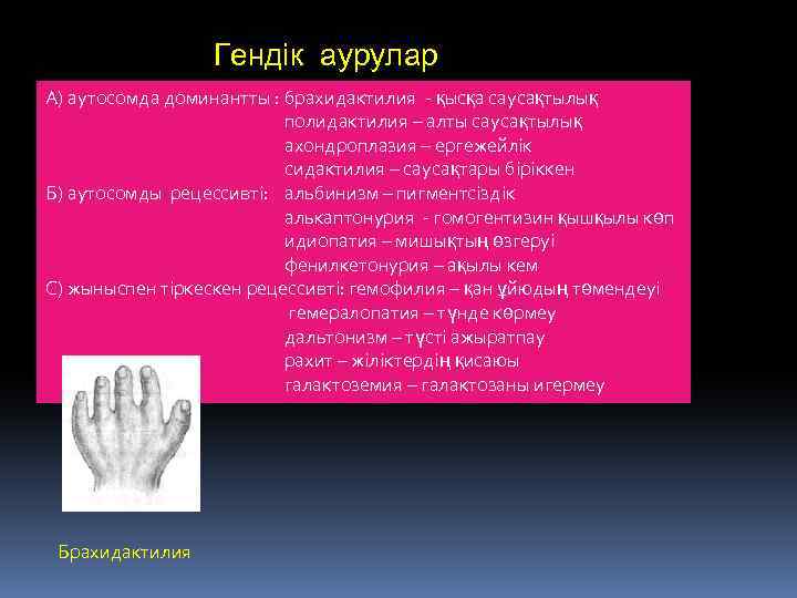 Гендік аурулар А) аутосомда доминантты : брахидактилия - қысқа саусақтылық полидактилия – алты саусақтылық