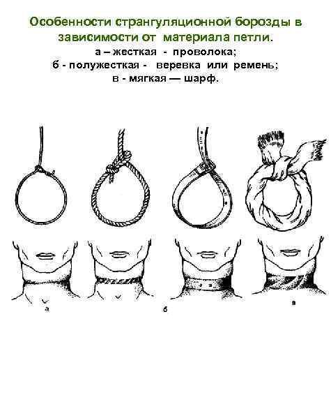 Странгуляционная асфиксия карта вызова смп