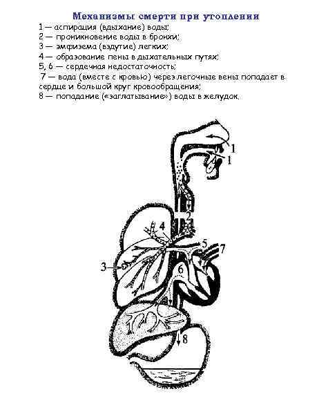 Механизмы смерти при утоплении 1 — аспирация (вдыхание) воды; 2 — проникновение воды в