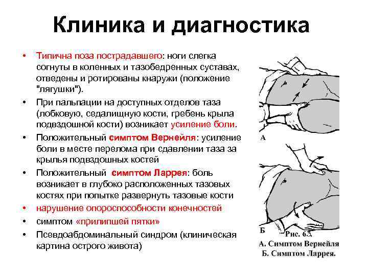 Клиническая картина сдавления мягких тканей находится в прямой зависимости от