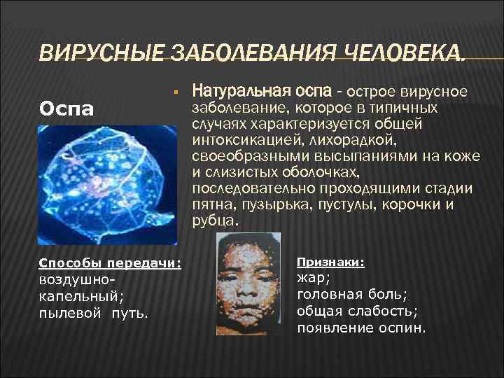 ВИРУСНЫЕ ЗАБОЛЕВАНИЯ ЧЕЛОВЕКА. Оспа § Способы передачи: воздушнокапельный; пылевой путь. Натуральная оспа - острое