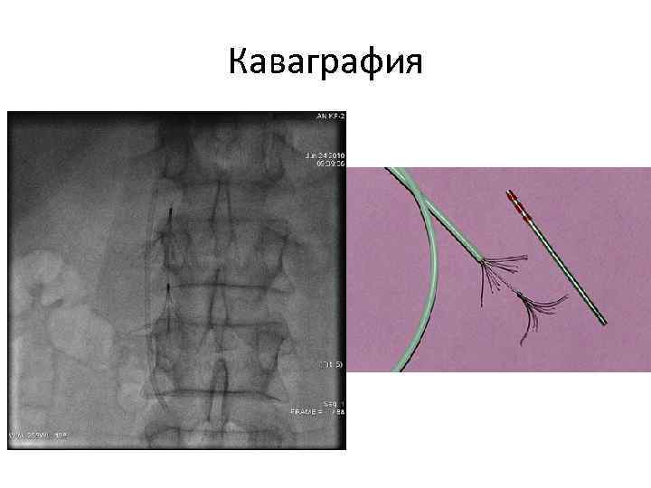 Каваграфия 